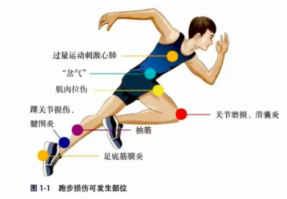 跑步技术动作的优劣直接影响运动效率和受伤风险